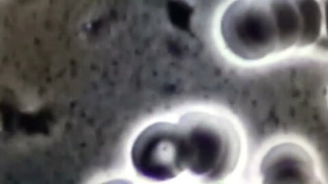 bacteria from eggs live blood video.