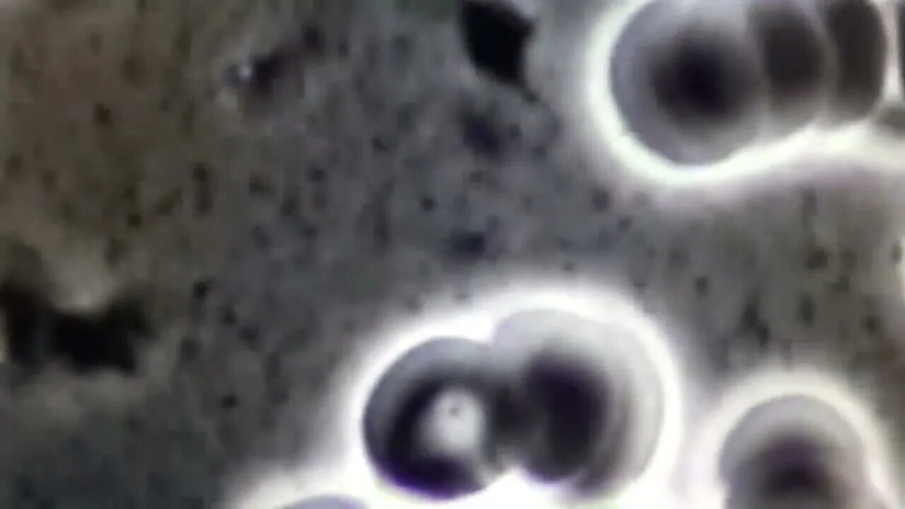 bacteria from eggs live blood video.