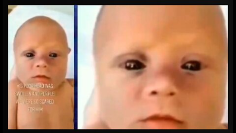 Dr. Viviane Brunet on Black-Eyed Babies!