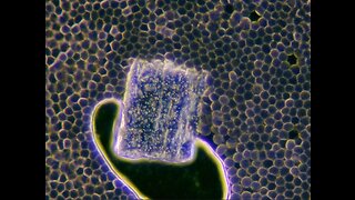 The Forced Evolution of Humanity: FIRST-HAND EVIDENCE of nanotechnology within the blood...
