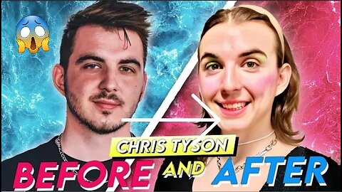 Chris Tyson /Before and After/ Mr beast co star HRT Transformation