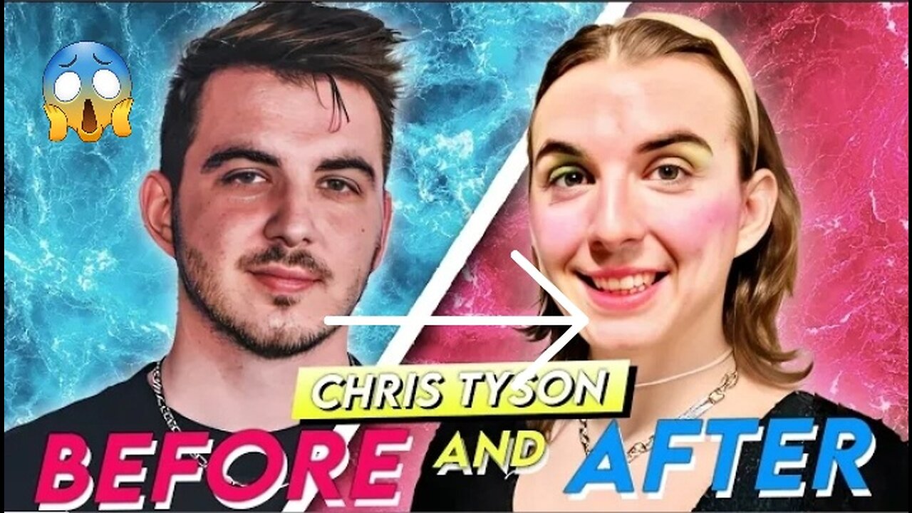 Chris Tyson /Before and After/ Mr beast co star HRT Transformation