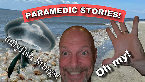 Jellyfish Stings!!! What Works?!