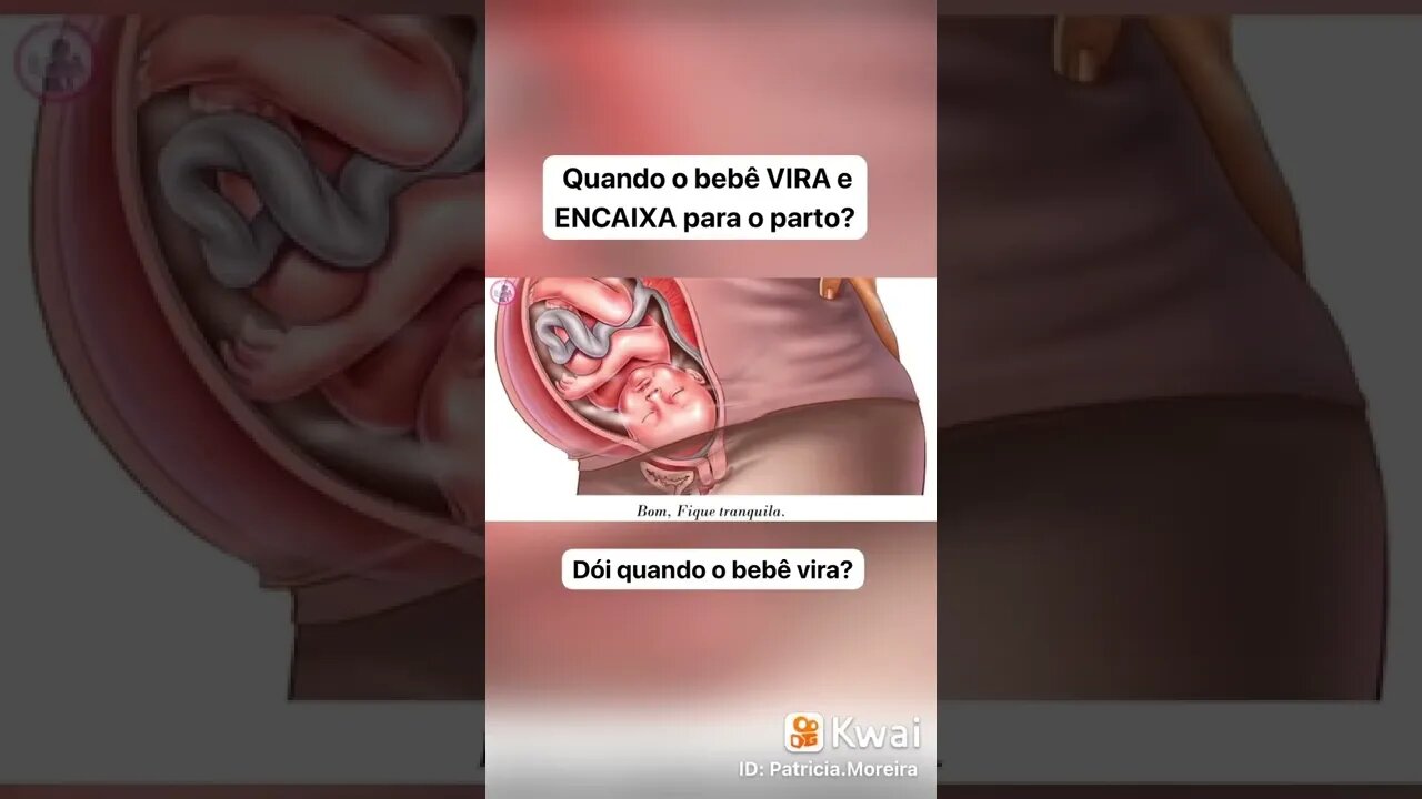 Quando o bebê vira e encaixa para o parto?