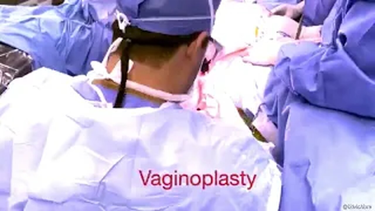 Vaginoplasty