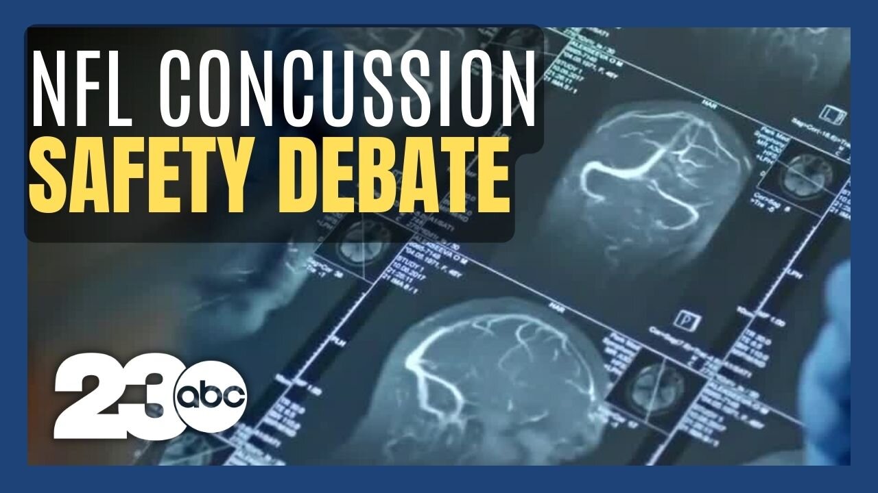 The debate about concussion safety in the NFL