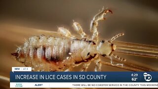 Lice cases increase in SD county