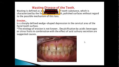 Periodontology L5 (Examination)