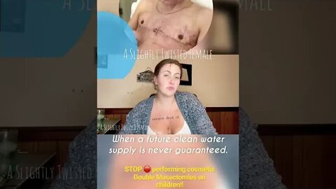 STOP performing COSMETIC Double Mastectomies on CHILDREN!!