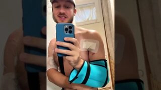 Pec Tear Surgery Update - New Dressings