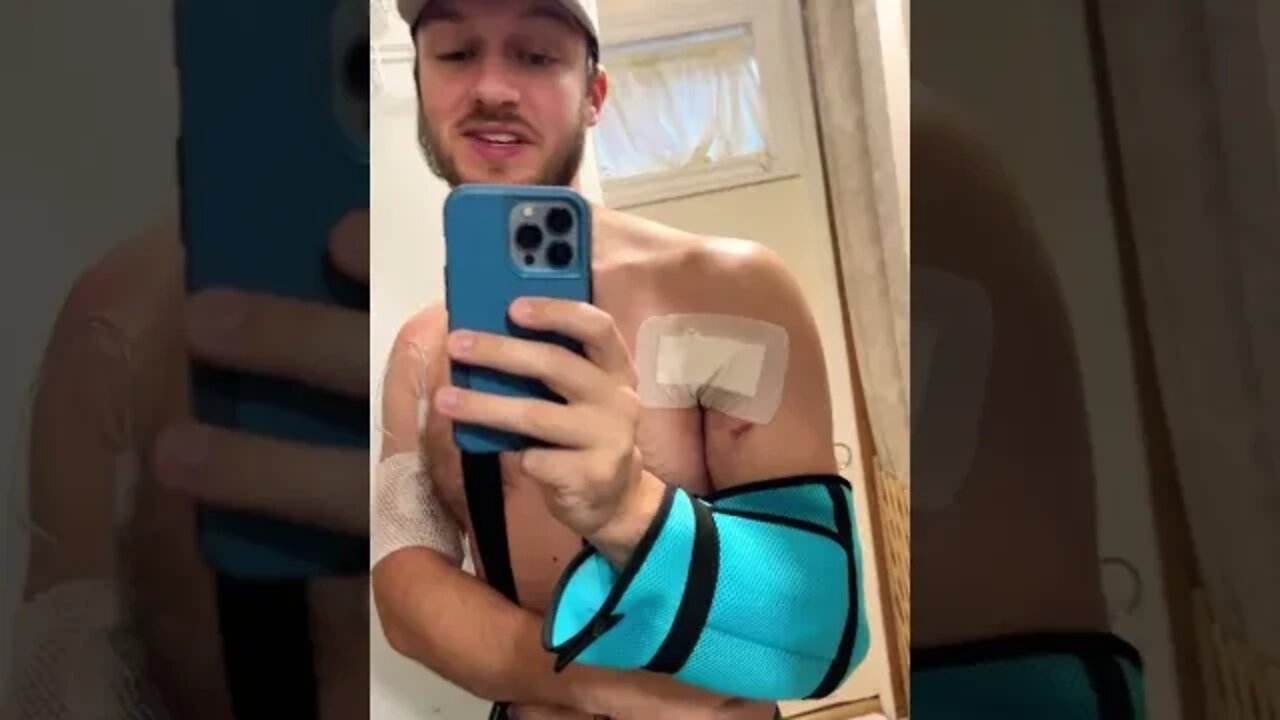 Pec Tear Surgery Update - New Dressings