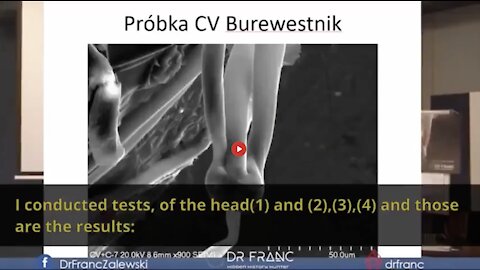 DR. FRANC ZALEWSKI - THE THING ! ANOTHER 'LIFE FORM' IN THE COVID VAX VIALS (ENGLISH SUBS)