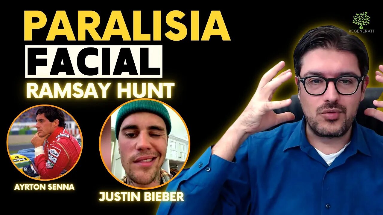 Paralisia Facial - Síndrome Ramsey Hunt