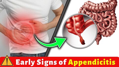 Early Warning Signs & Symptoms of Appendicitis