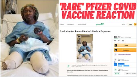 Minnesota Woman Loses Both Legs & Hands After PFIZER COVID VACCINE!