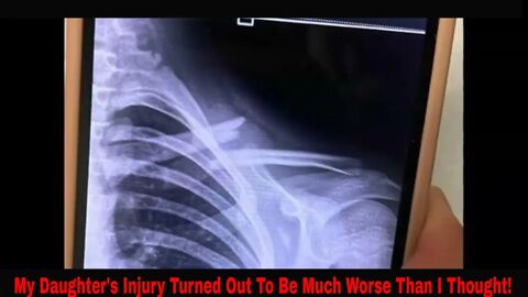 My Daughters Injury Turned Out To Be Much Worse Than I Thought!