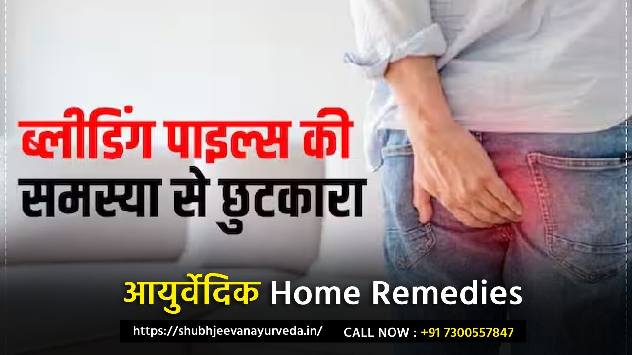 Piles / बवासीर का घरेलु उपचार | Best 5 Home Remedies For Piles Problem Solution Without Surgery