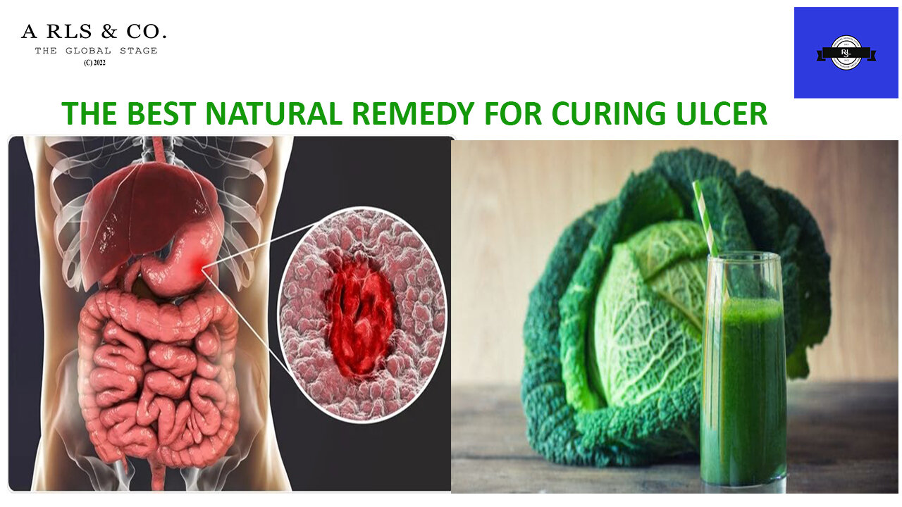 THE BEST NATURAL REMEDY FOR CURING PEPTIC ULCER