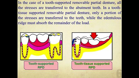 Prosthodontics L10 (Rest And Rest Seats)