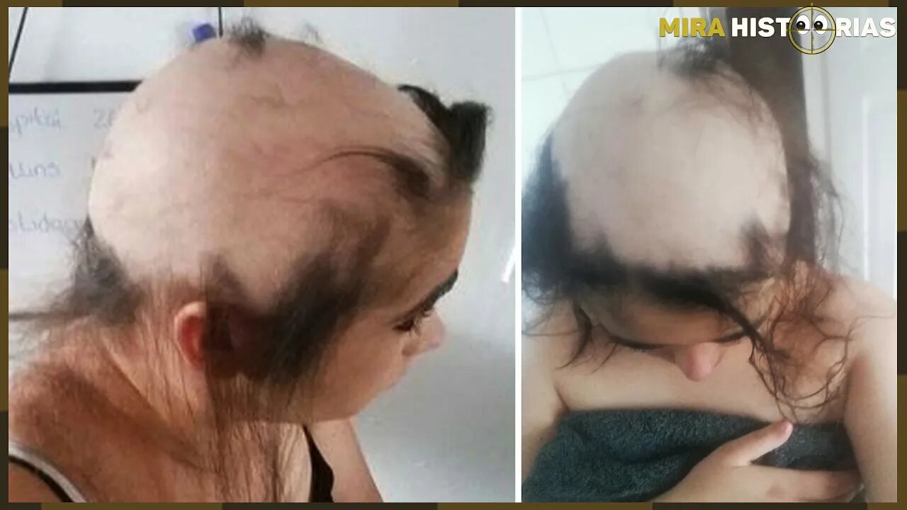 Britânica acorda com a cabeça sem cabelo. Em seguida, 'prova' que a causa é o convívio infeliz