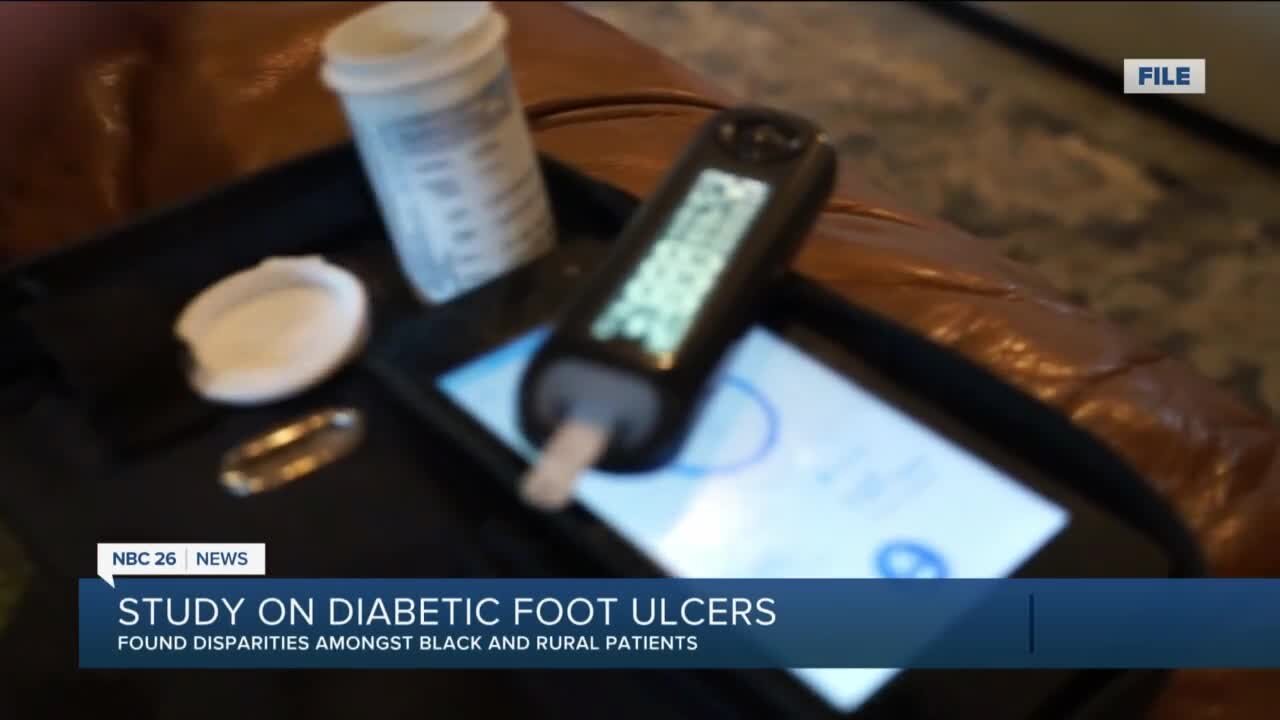 Diabetic Ulcers