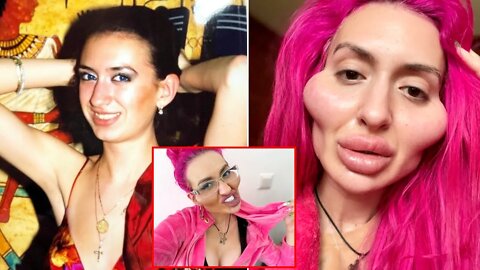 When Plastic Surgery Jobs Go Wrong (Part 2)