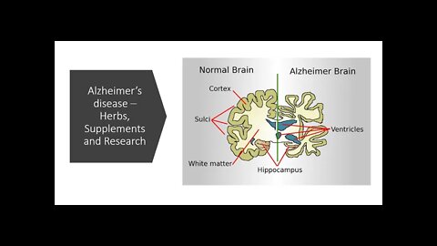 Alzheimer's disease - Herbs, supplements & nutrients.