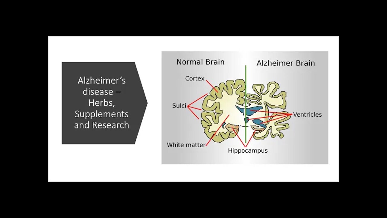 Alzheimer's disease - Herbs, supplements & nutrients.