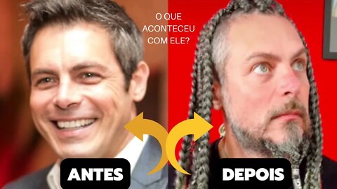 Antes e Depois do ator Luigi Baricelli, ex galã da Globo