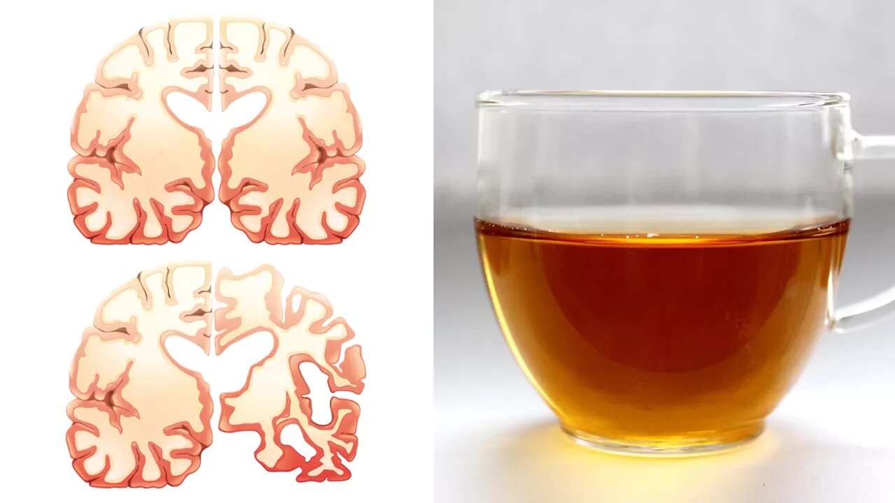 Drinking Tea Can Reduce Your Alzheimer’s Risk By 86%, Study Finds