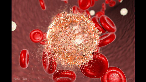 Woman curing her blood cancer by taking curcumin from turmeric