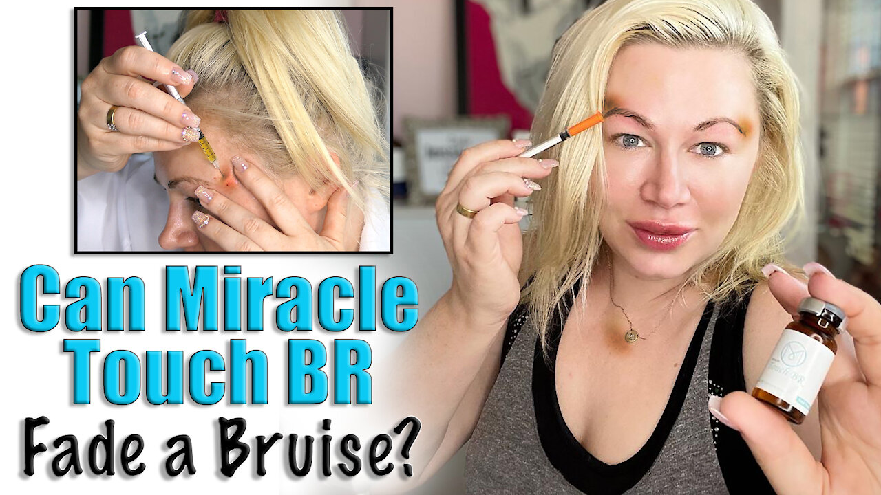 How to Fade a Bruise | Code Jessica10 saves you $$$