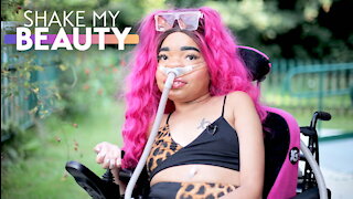 My 24/7 Ventilator Hasn't Stopped Me Modelling | SHAKE MY BEAUTY