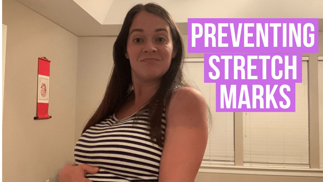 Stretch Marks - Preventing Them In Pregnancy!