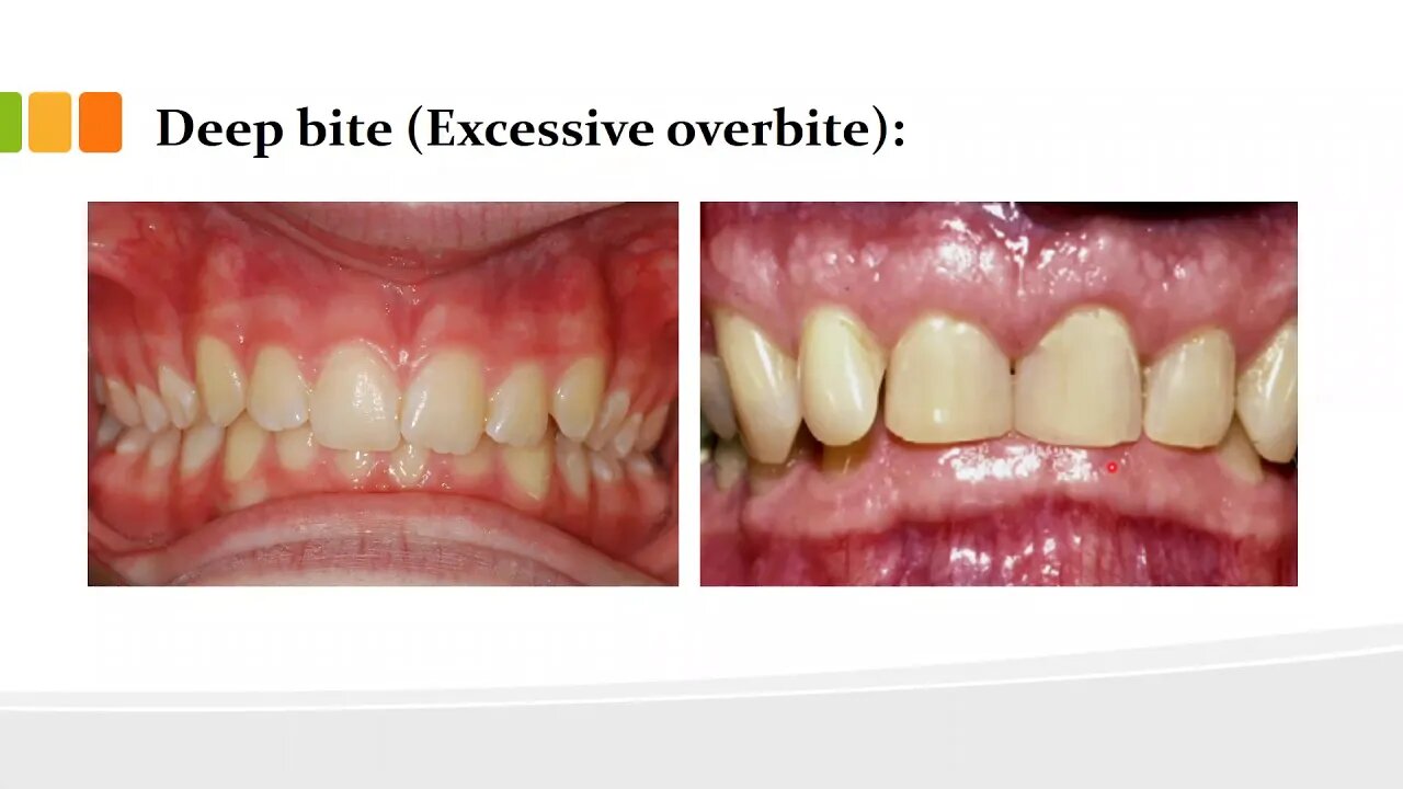 orthodontics L2 part1 (definitions)