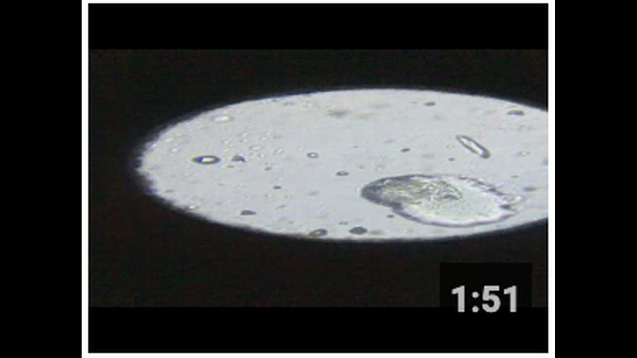 Synthetic biology lipid nanoparticle. This came out of my skin! (Part 2)