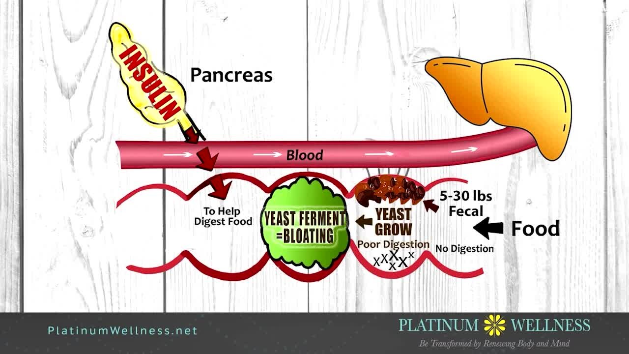 Platinum Wellness: Get a plan to FINALLY lose weight