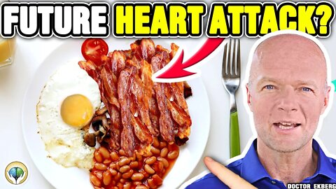 Is CHOLESTEROL BAD For You? (Real Doctor Reviews The TRUTH)