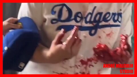 Dodgers Fan Destroys Hands pt.2