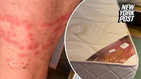 Nasty bed bugs ruined couple's vacation — and followed them home