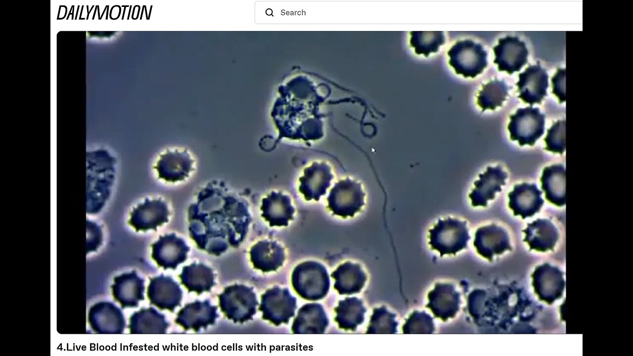 Is Cancer Caused by Microparasites in Your Cells and Low Frequency?