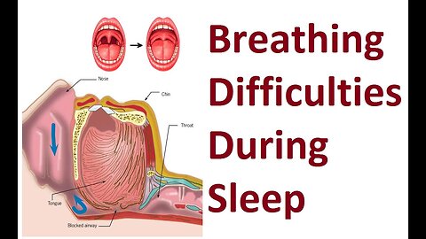 Methods to Improve Breathing Difficulties During Sleep by Prof John Mew