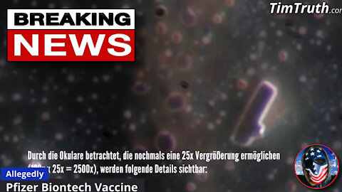 WOW! mRNA “Vaccines” Thru Microscope! Allegedly The Pfizer & Moderna “Vaccines”!