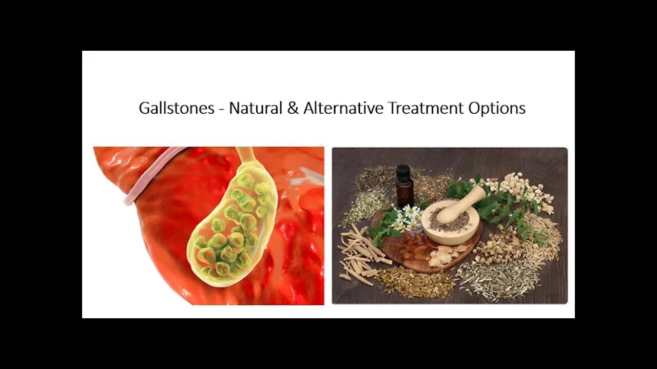 Gallstones Natural Treatment