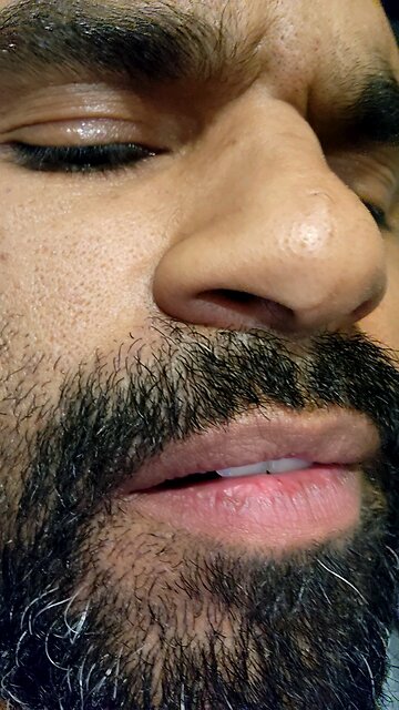 self sealing operation