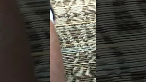 What's wrong with my legs? I think it's dry skin.