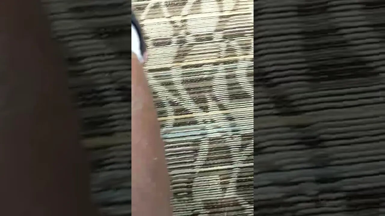 What's wrong with my legs? I think it's dry skin.