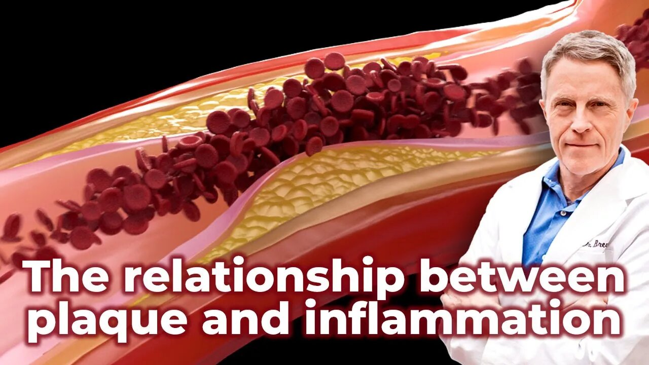 The relationship between plaque and inflammation