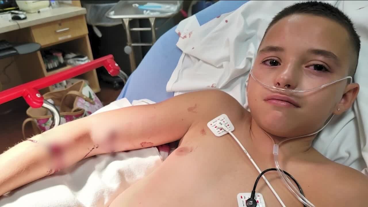 Denver boy with autism, epilepsy recovering after he was shot while in car with mother