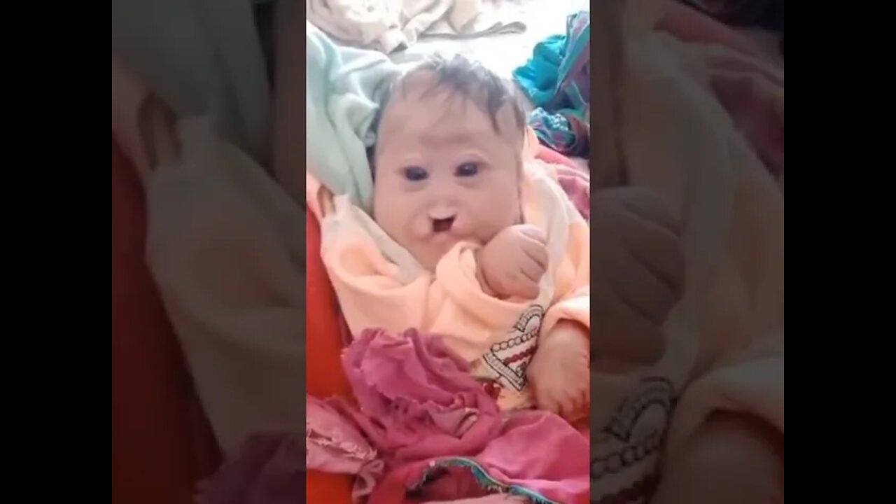 New born baby😲